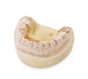 Dental model with jaw isolated on white. Cast of teeth
