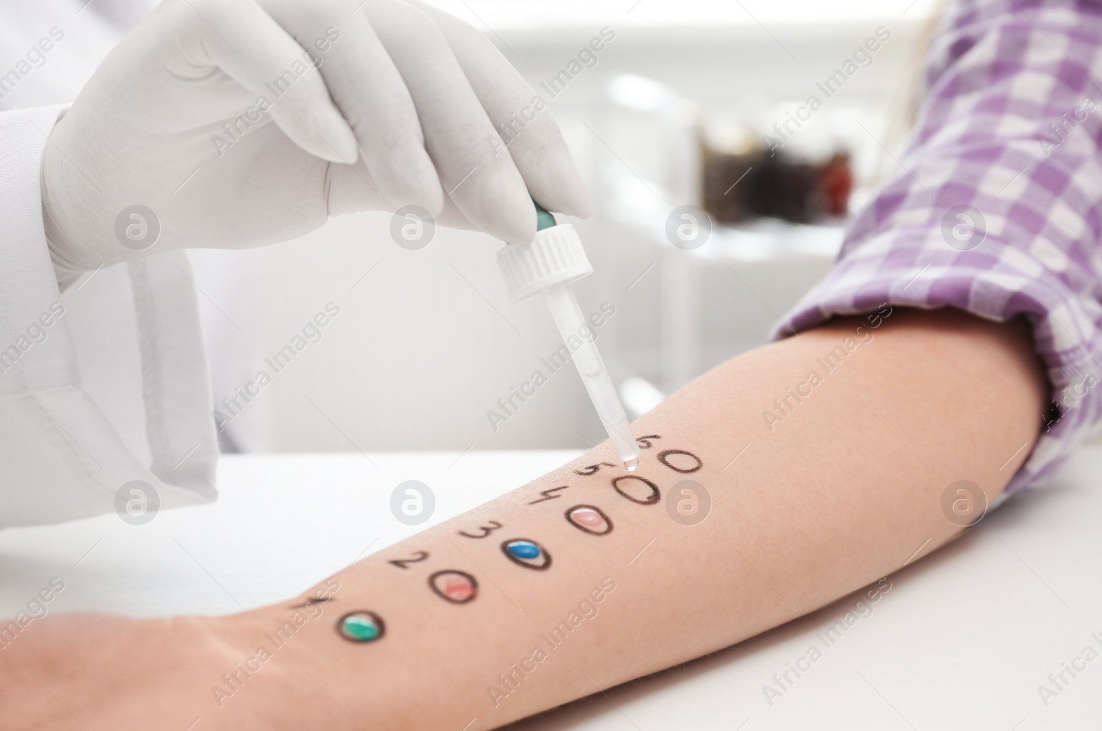 Photo of Patient undergoing skin allergy test at light table, closeup