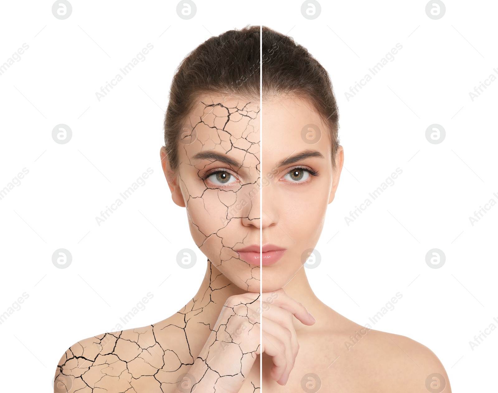 Image of Collage with photos of woman having dry skin problem before and after dry skin problem on white background