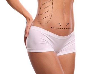 Woman with markings for cosmetic surgery on her abdomen against white background, closeup