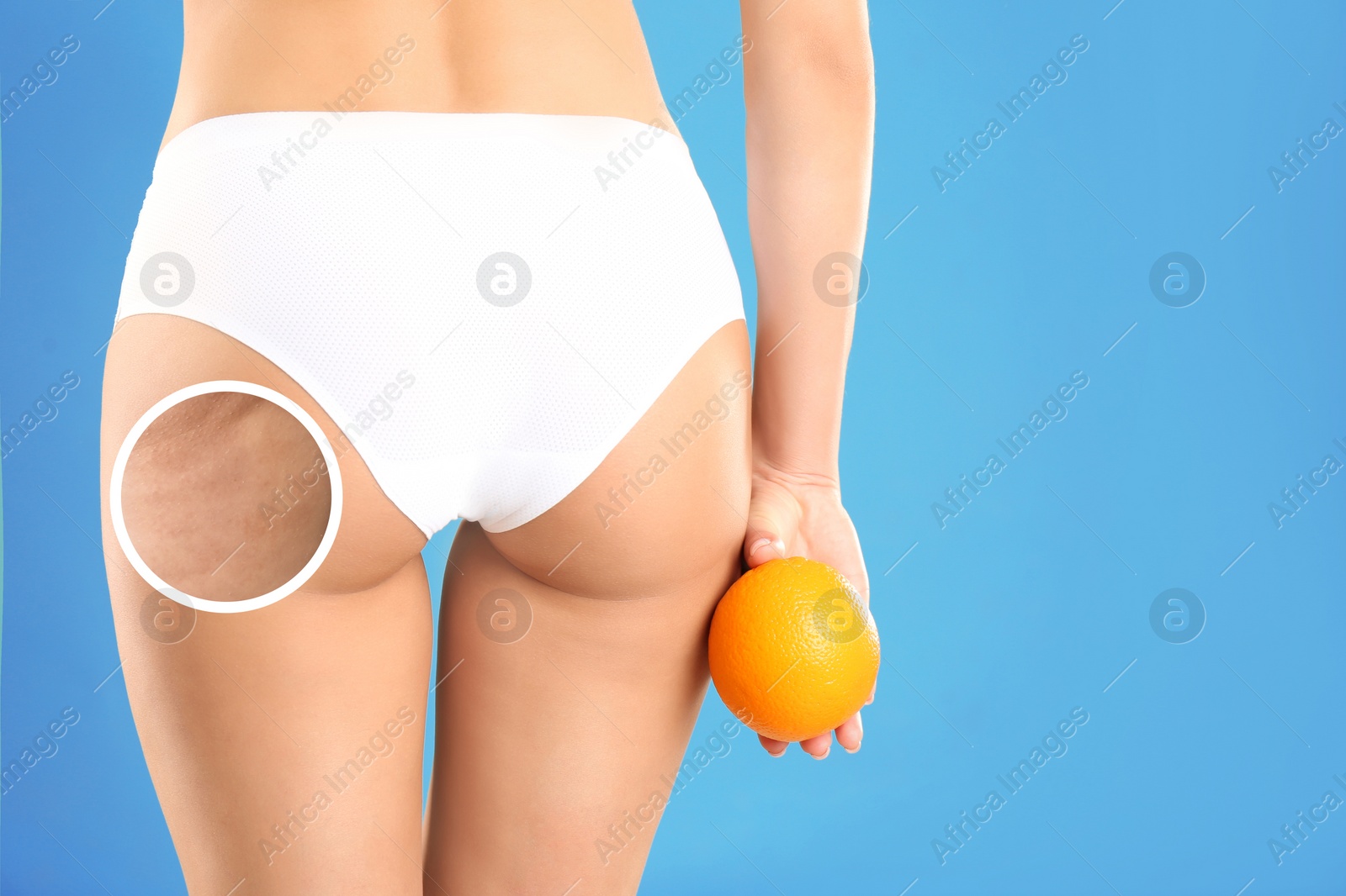 Image of Cellulite problem. Slim woman in underwear holding orange on light blue background, closeup. Zoomed skin with dimples