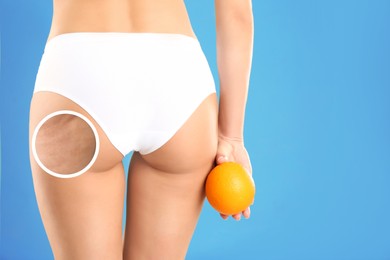 Cellulite problem. Slim woman in underwear holding orange on light blue background, closeup. Zoomed skin with dimples