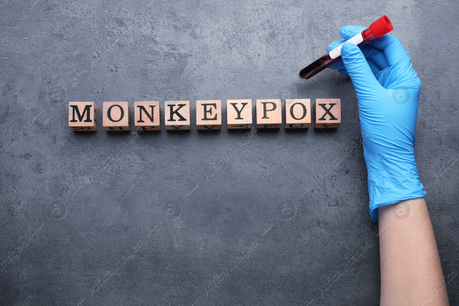 Photo of Word Monkeypox made of wooden cubes on grey table, top view. Doctor holding test tube with blood sample, closeup