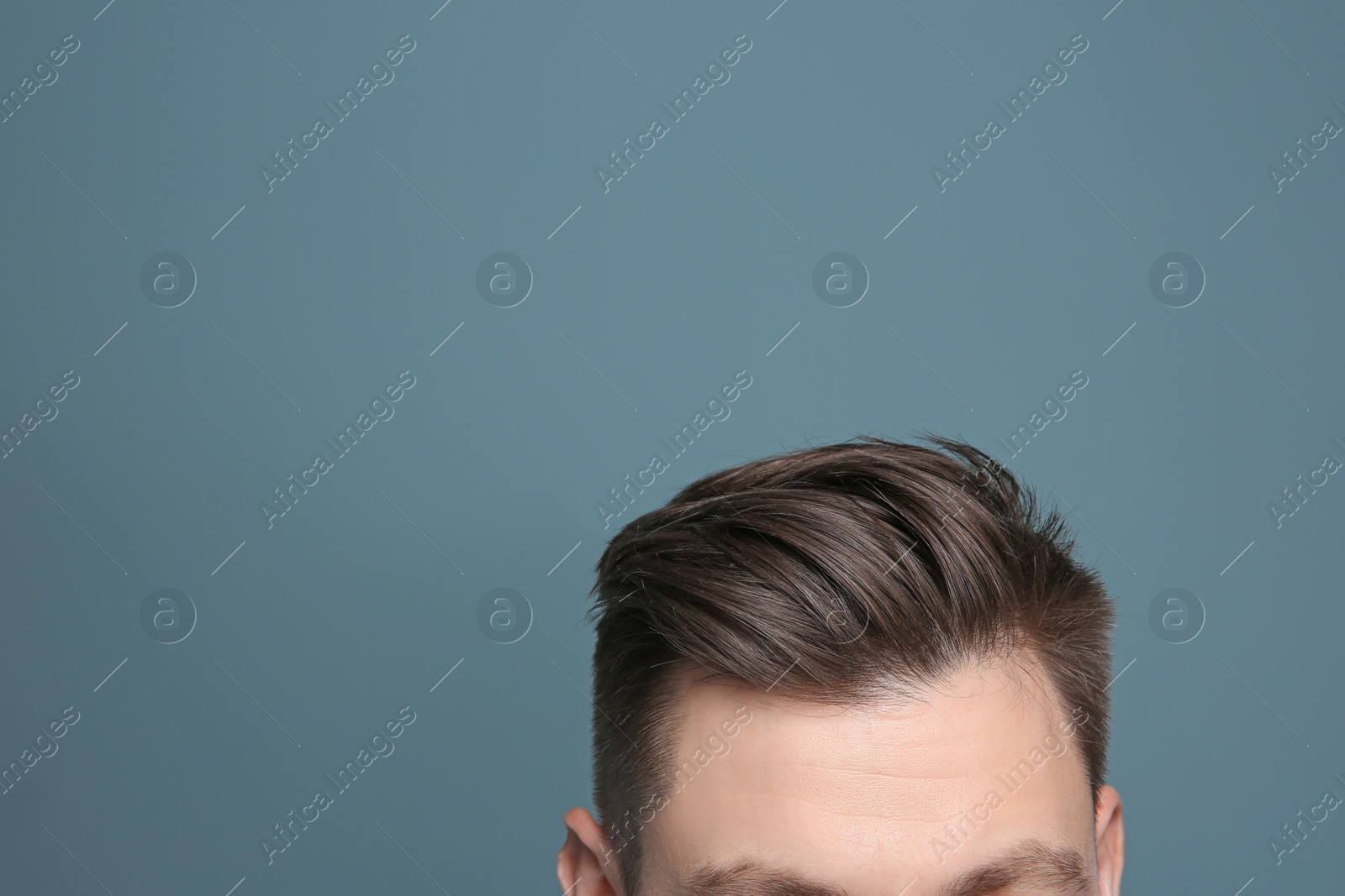 Photo of Young man with hair loss problem on color background