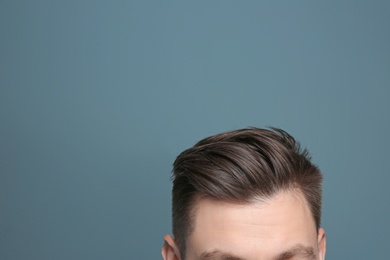 Photo of Young man with hair loss problem on color background