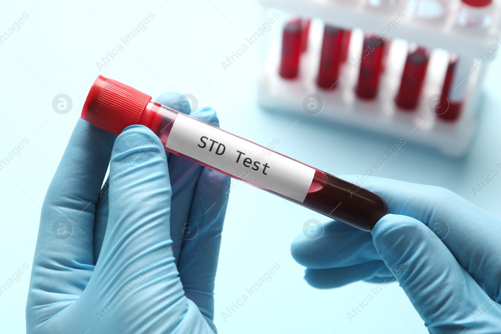 Photo of Scientist holding tube with blood sample and label STD Test on light blue background, closeup