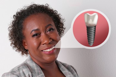 Image of Happy African American woman with perfect teeth smiling on white background. Illustration of dental implant
