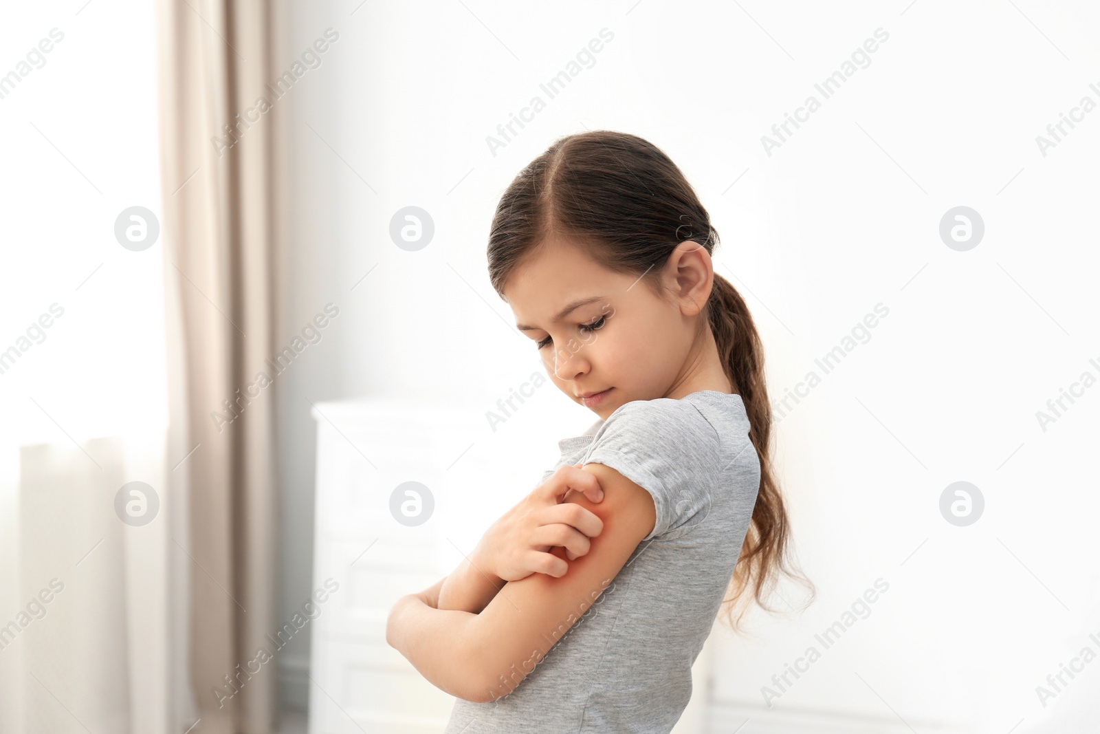 Photo of Little girl scratching arm indoors. Allergy symptoms