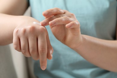 Photo of Woman applying ointment onto her hand, closeup
