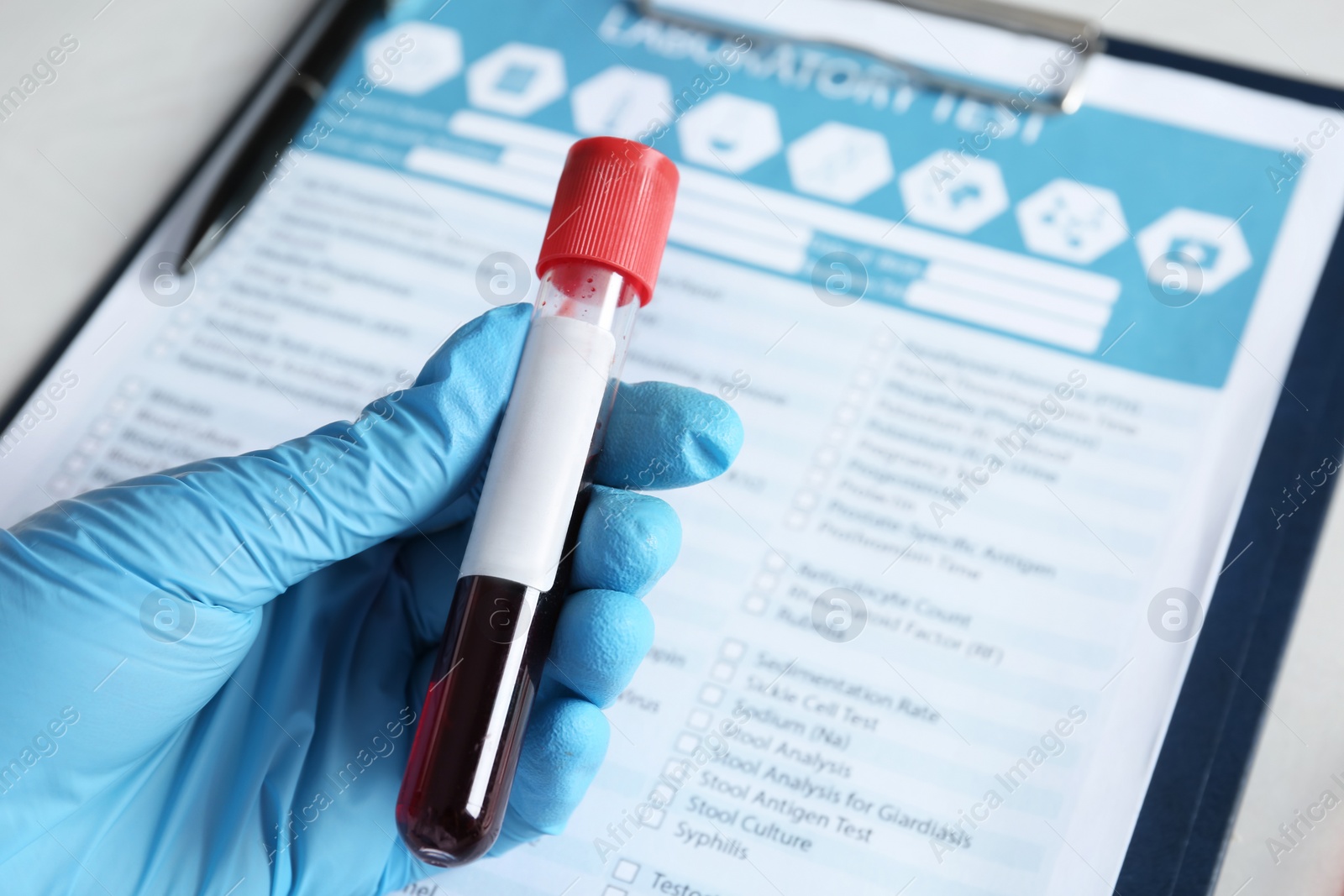 Photo of Laboratory worker holding test tube with blood sample for analysis beside medical form, closeup