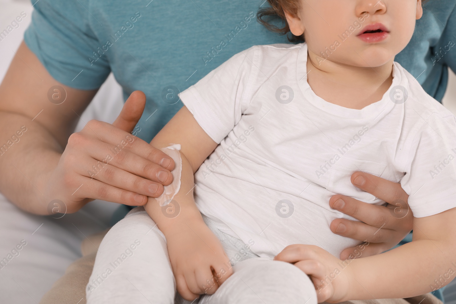 Photo of Father applying ointment onto his son`s arm, closeup