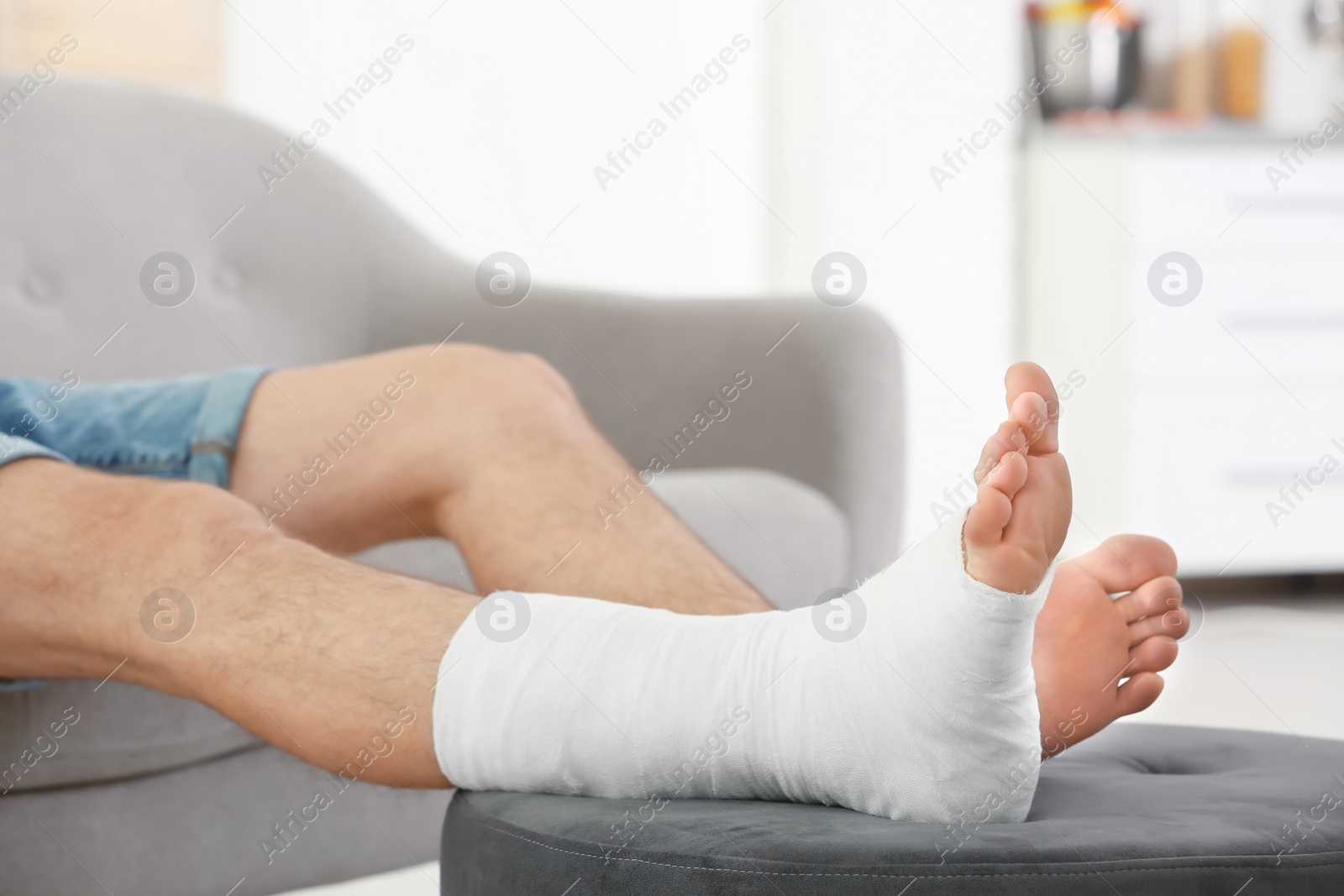 Photo of Young man with broken leg in cast sitting on sofa at home