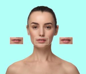 Attractive woman with beautiful lips on cyan background. Zoomed areas showing difference in lip fullness due to cosmetic procedure