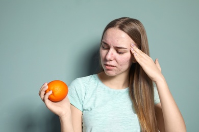 Young woman with acne problem holding orange on color background. Skin allergy