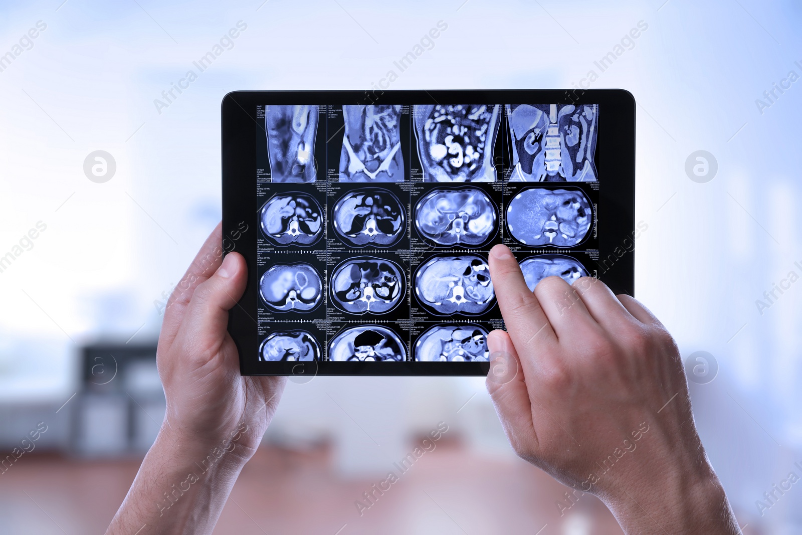 Image of Doctor examining x-ray images on tablet indoors, closeup