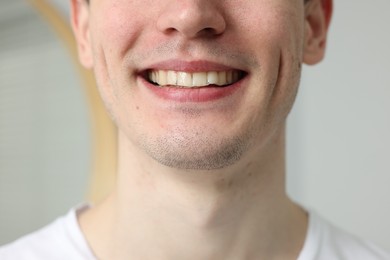 Photo of Young man using whitening strip on blurred background, closeup