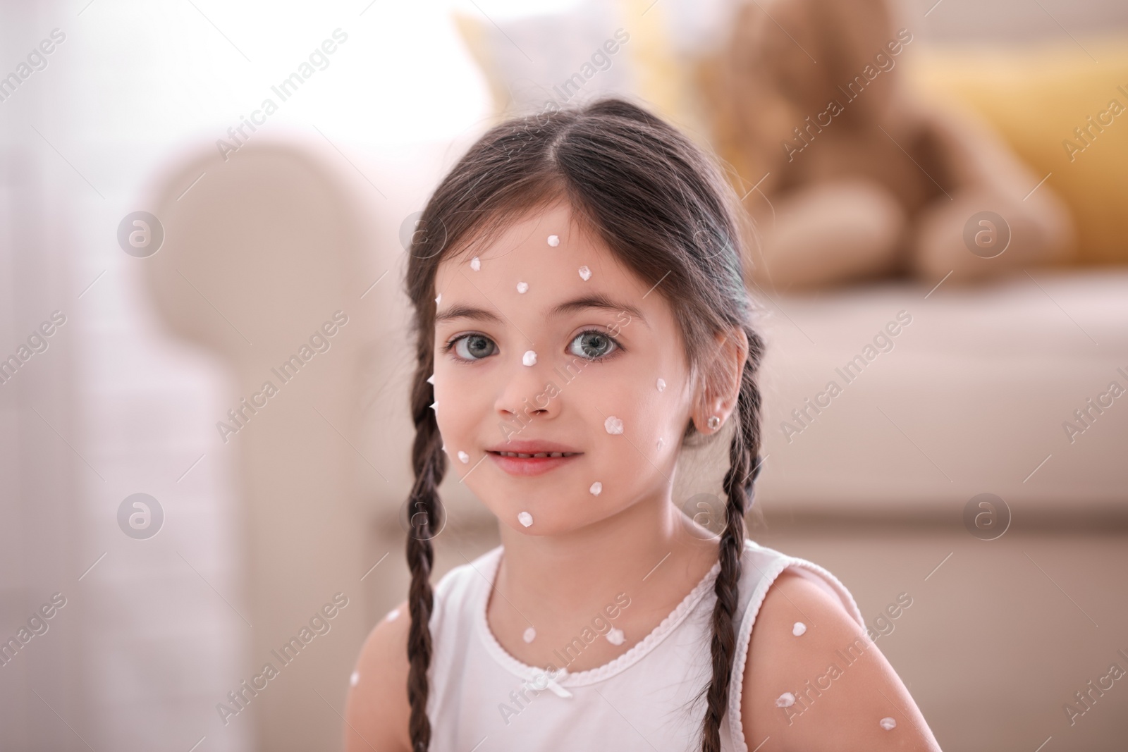 Photo of Adorable little girl with chickenpox at home