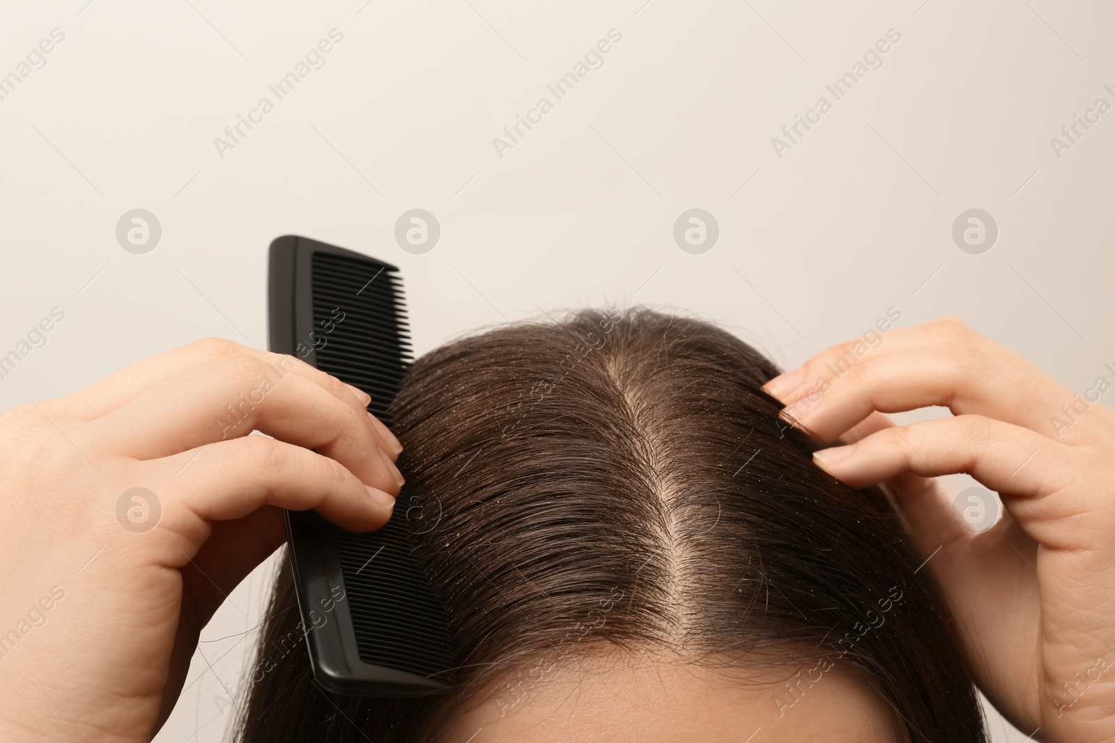 Photo of Woman with comb and dandruff in her dark hair on light background, closeup