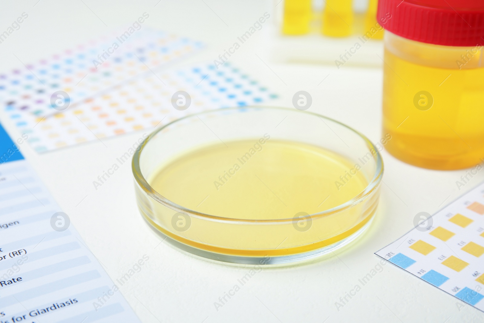 Photo of Petri dish with urine sample for analysis on white table