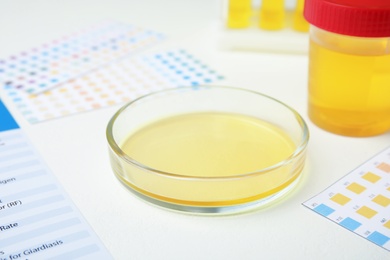 Photo of Petri dish with urine sample for analysis on white table