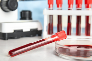 Test tube and Petri dish with blood samples on table in laboratory, closeup. Virus research