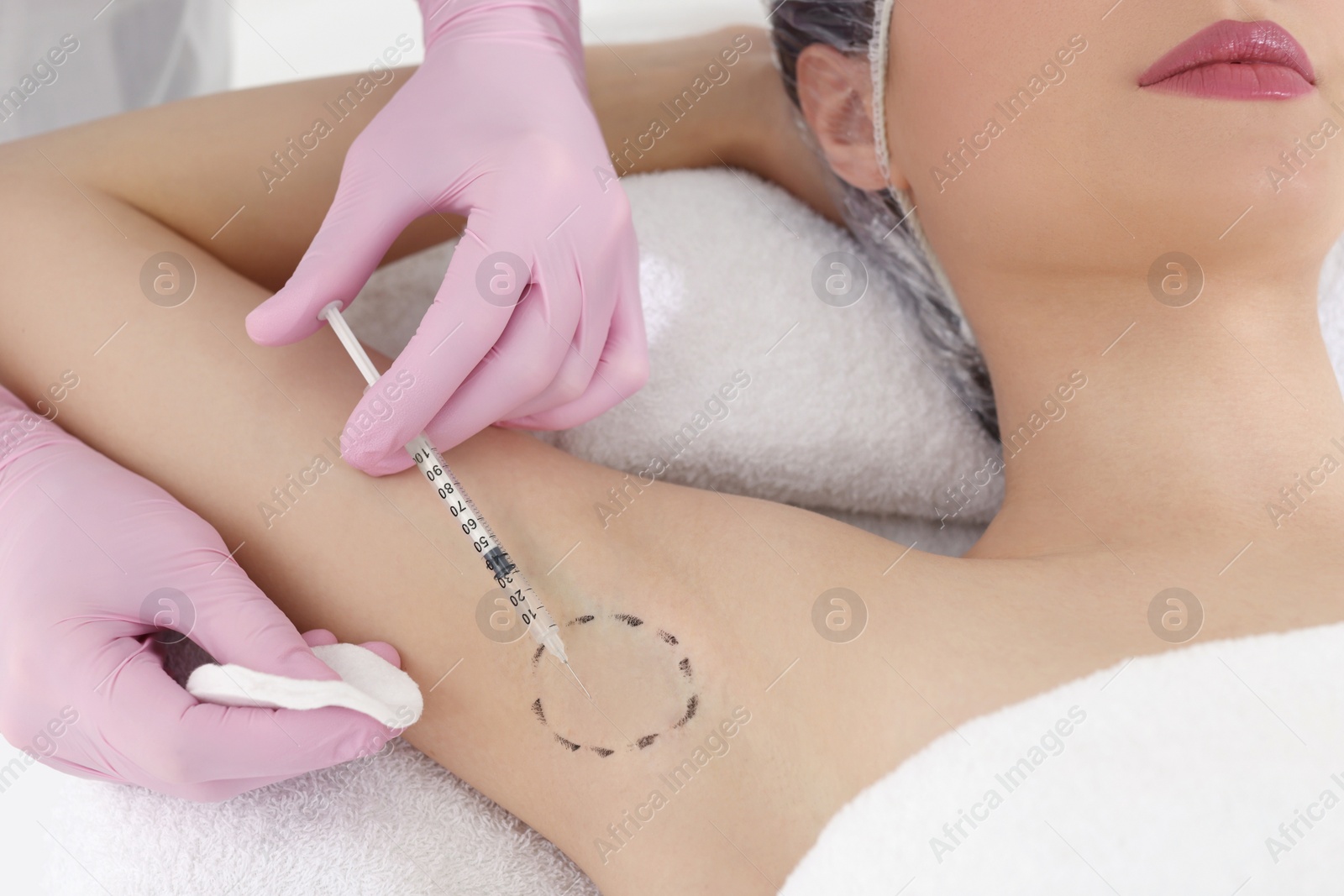 Photo of Cosmetologist injecting young woman's armpit, closeup. Treatment of hyperhidrosis