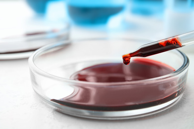 Dripping blood from pipette into Petri dish on table, closeup. Laboratory analysis