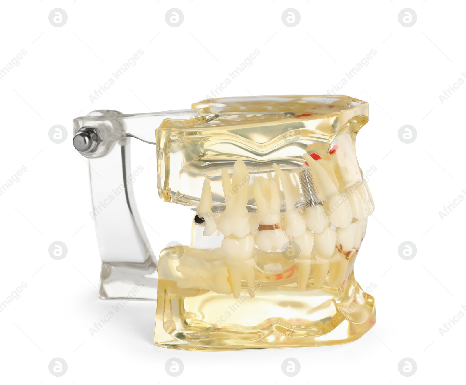 Photo of Educational dental typodont model isolated on white