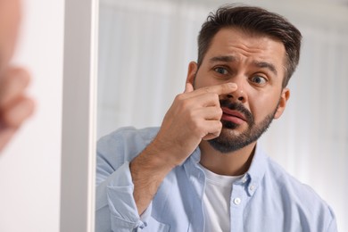 Confused man with skin problem looking at mirror indoors