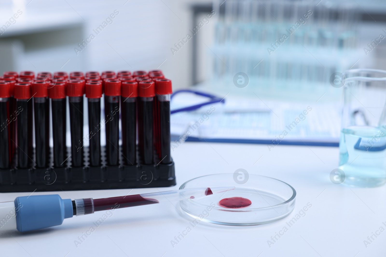 Photo of Dripping blood sample onto Petri dish on white table in laboratory, closeup