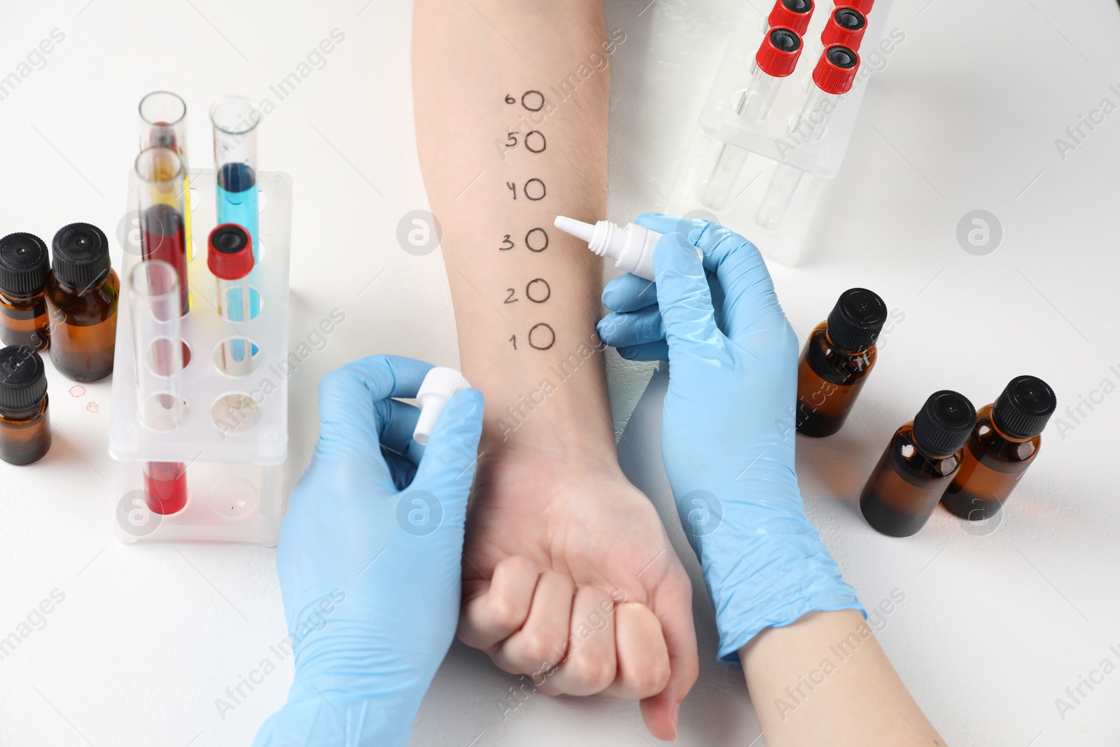 Photo of Doctor doing skin allergy test at light table, above view