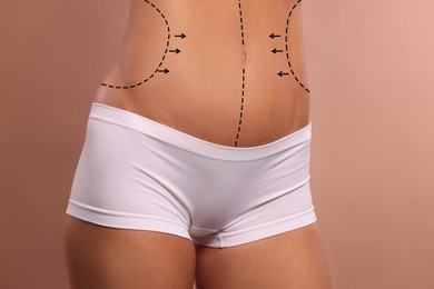 Woman with markings for cosmetic surgery on her abdomen against light brown background, closeup