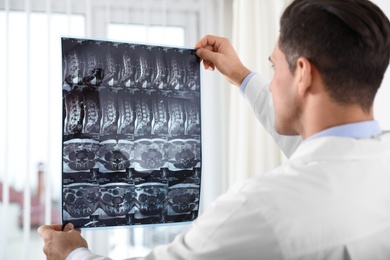 Photo of Orthopedist examining X-ray picture near window in office