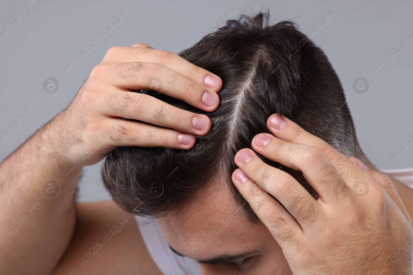 Photo of Man examining his head on light grey background, closeup. Dandruff problem