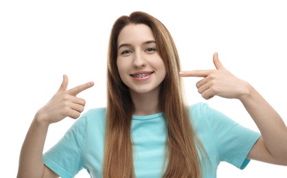 Portrait of smiling woman pointing at her dental braces on white background