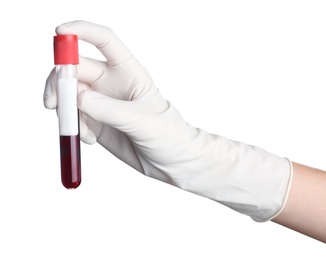 Photo of Doctor holding glass tube with blood on white background, closeup. Allergy test