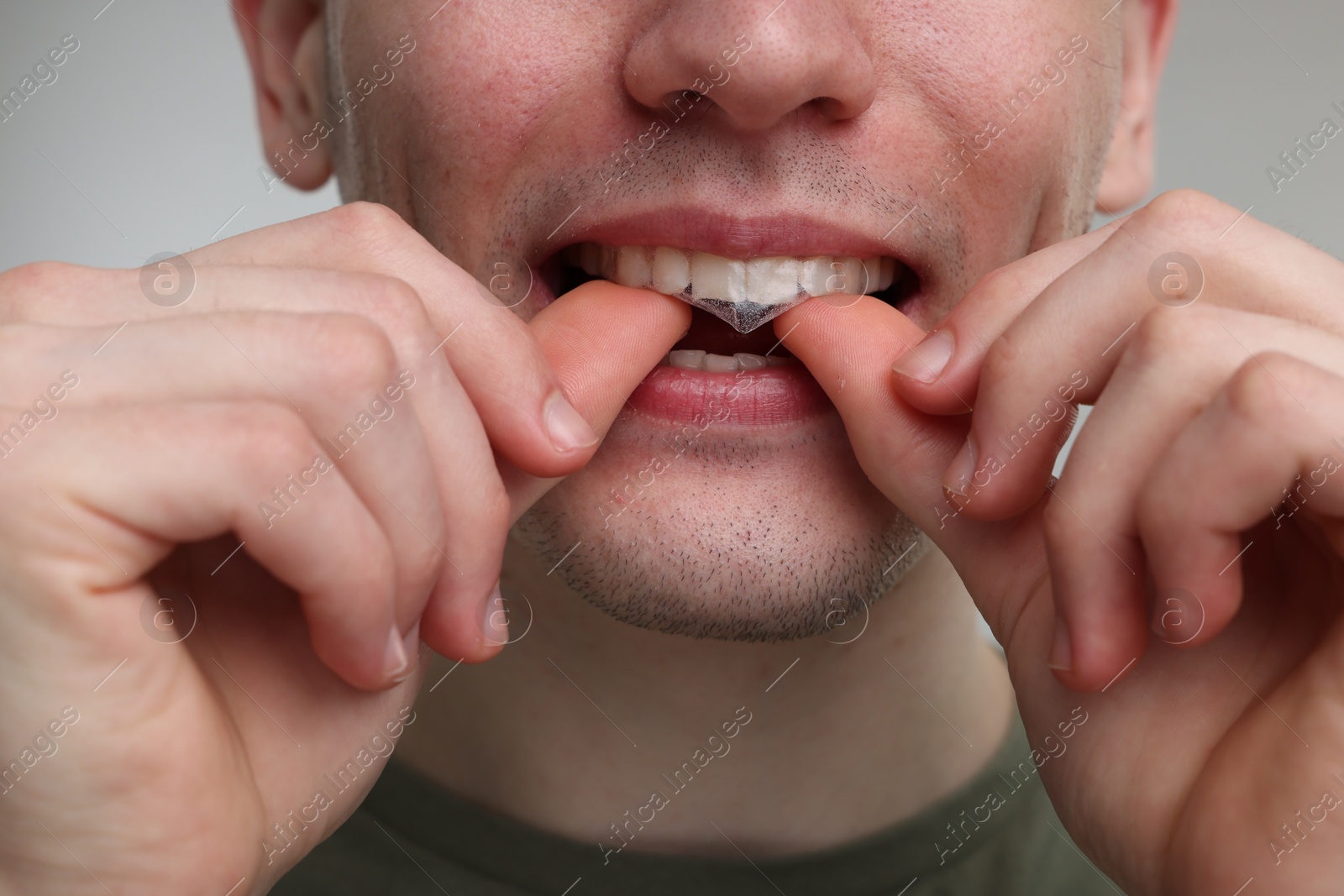 Photo of Young man applying whitening strip on his teeth against light grey background, closeup