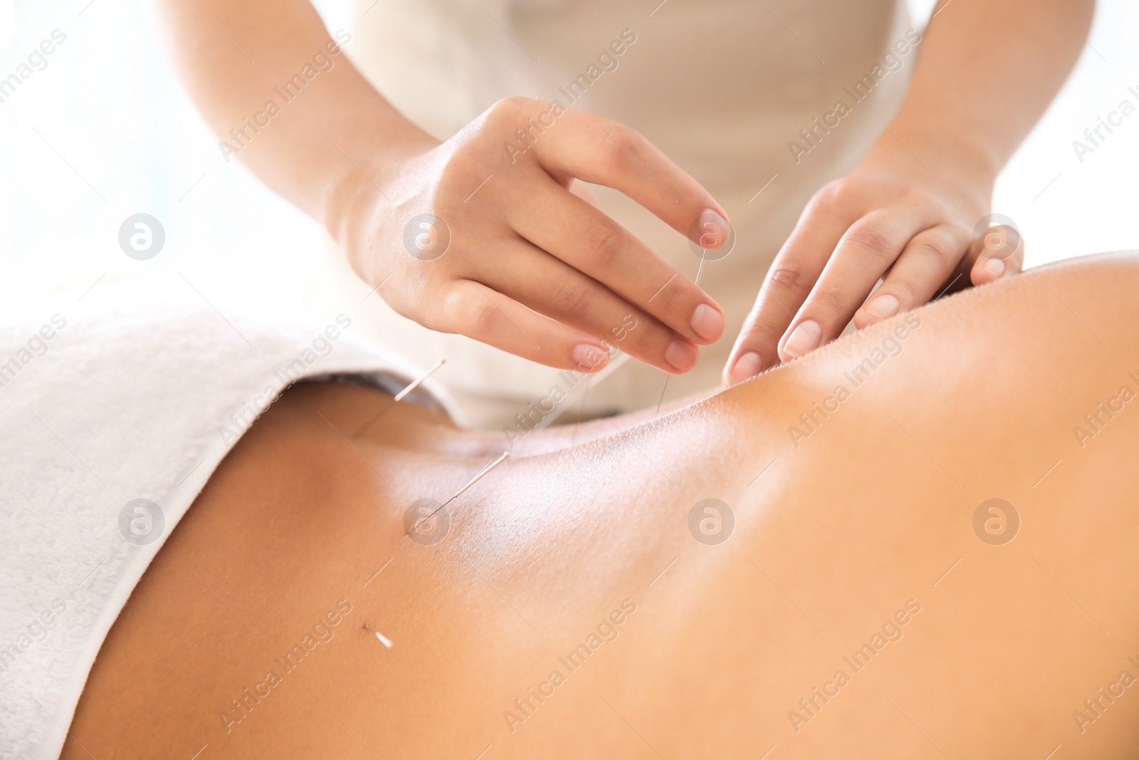 Photo of Young man undergoing acupuncture treatment in salon, closeup