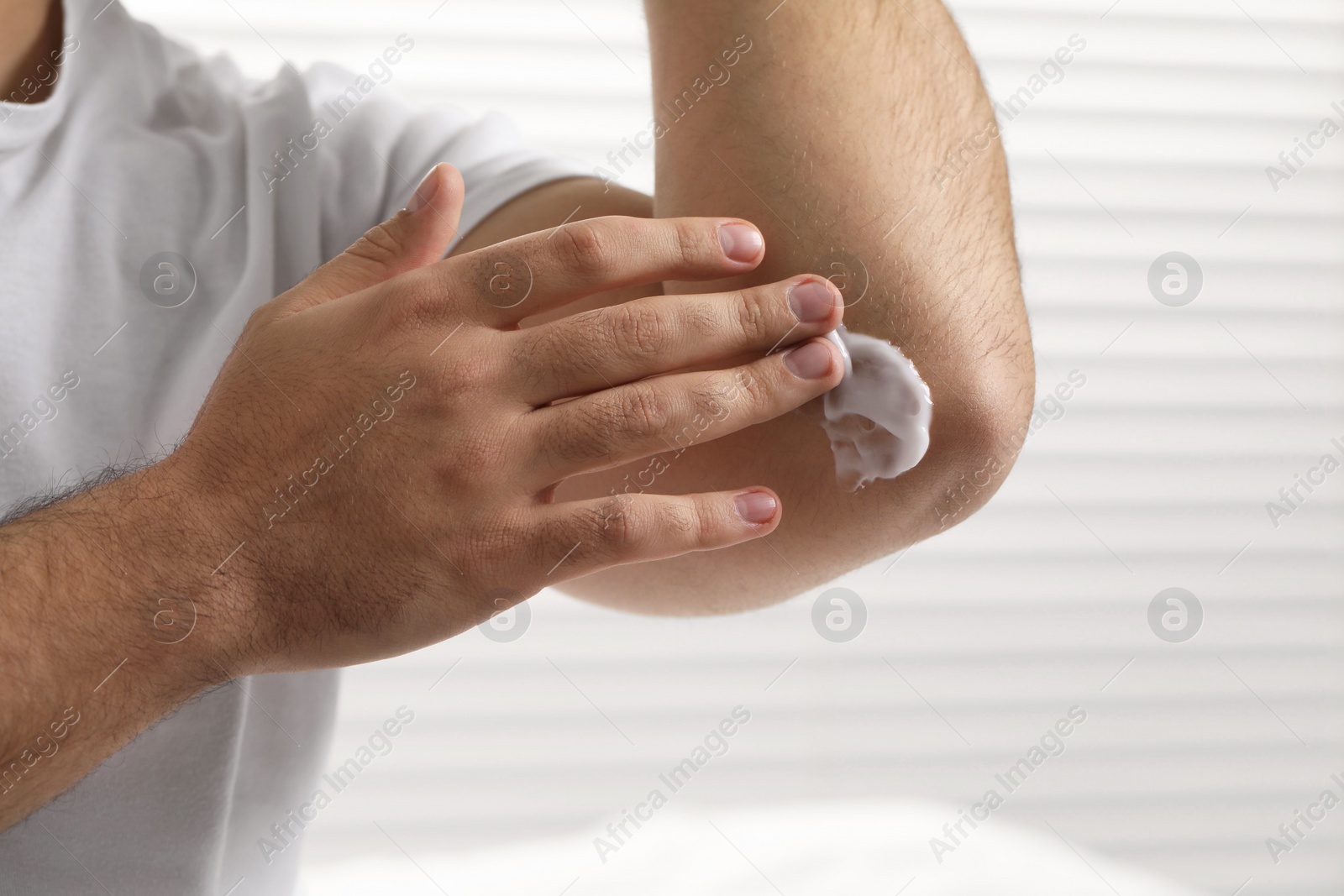 Photo of Man with dry skin applying cream onto his elbow on light background, closeup