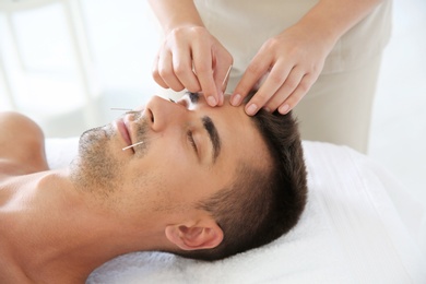 Photo of Young man undergoing acupuncture treatment in salon