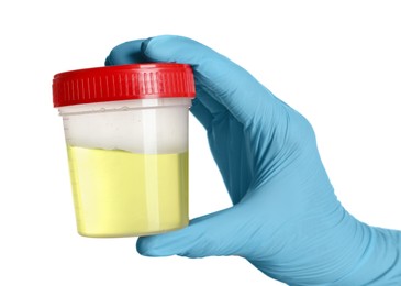 Doctor in gloves holding container with urine sample for analysis on white background, closeup