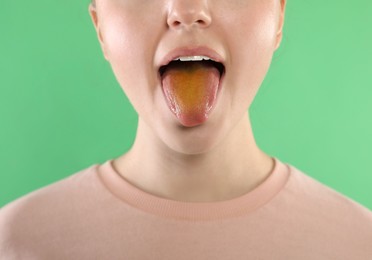 Photo of Gastrointestinal diseases. Woman showing her yellow tongue on green background, closeup