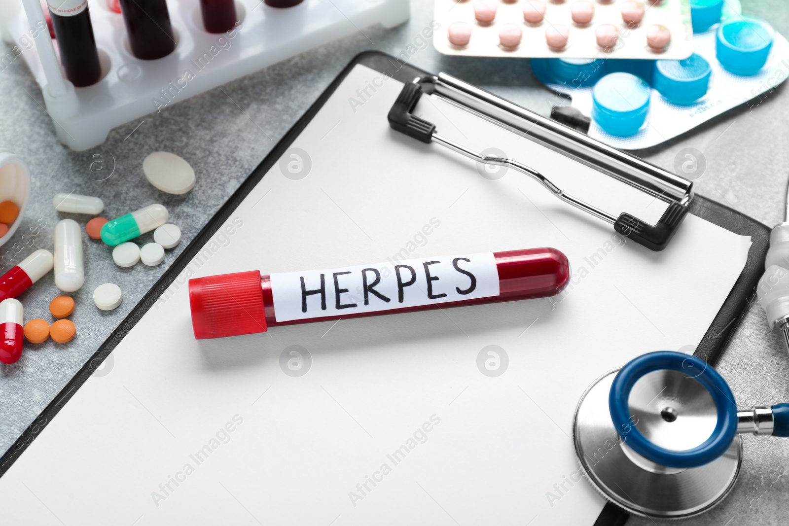 Photo of Test tube with word Herpes, different pills, clipboard and stethoscope on light grey table