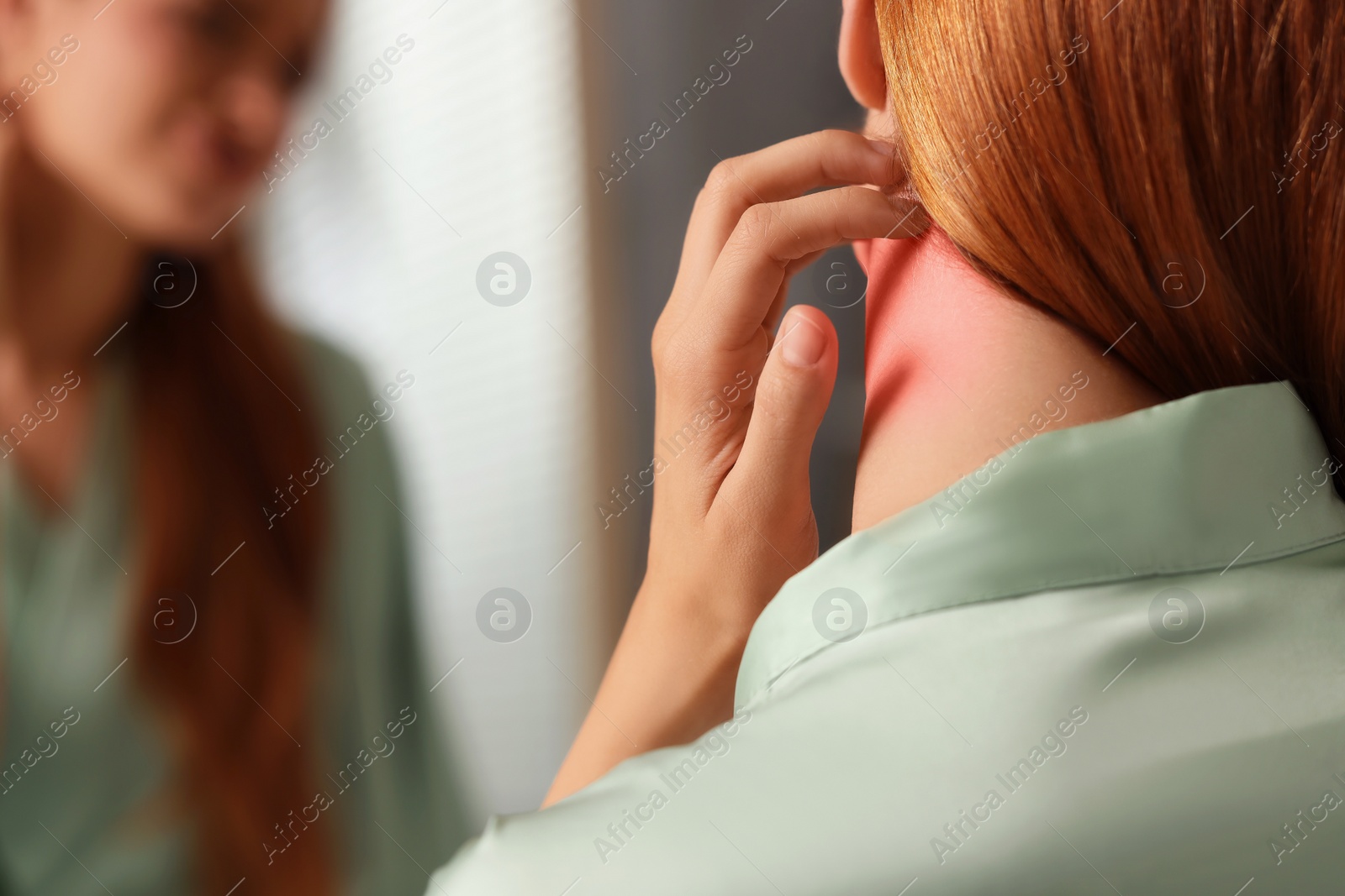 Photo of Suffering from allergy. Young woman scratching her neck near mirror indoors, closeup. Space for text