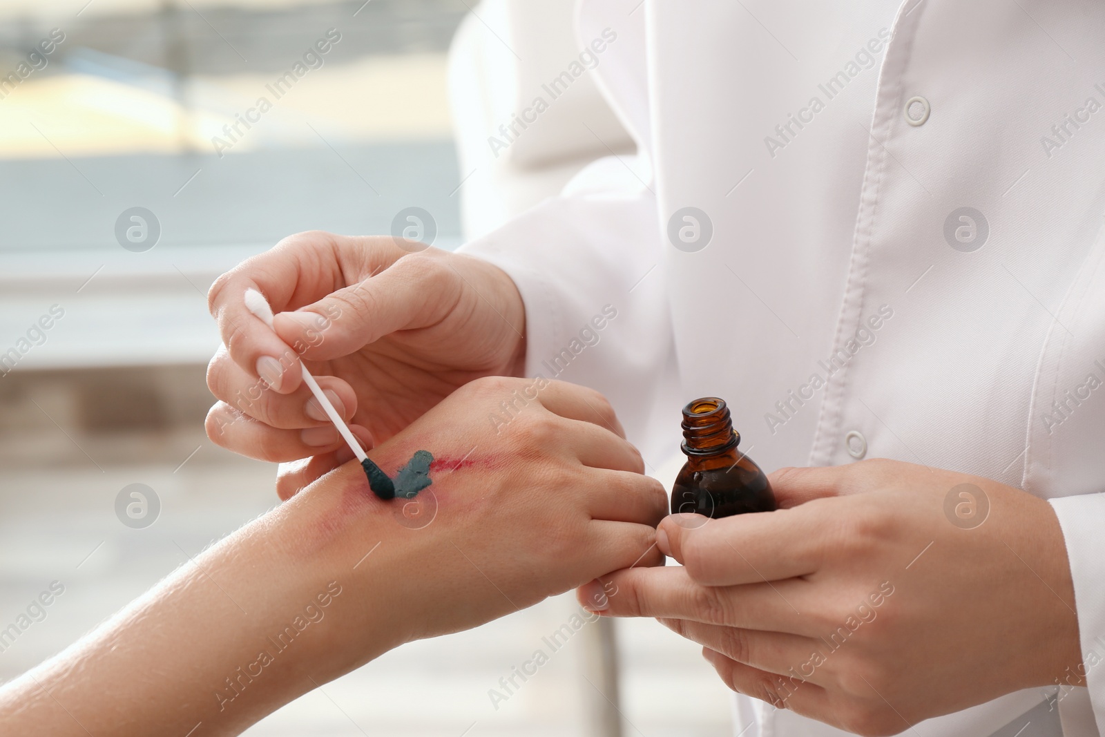 Photo of Doctor applying brilliant green onto injured hand indoors, closeup