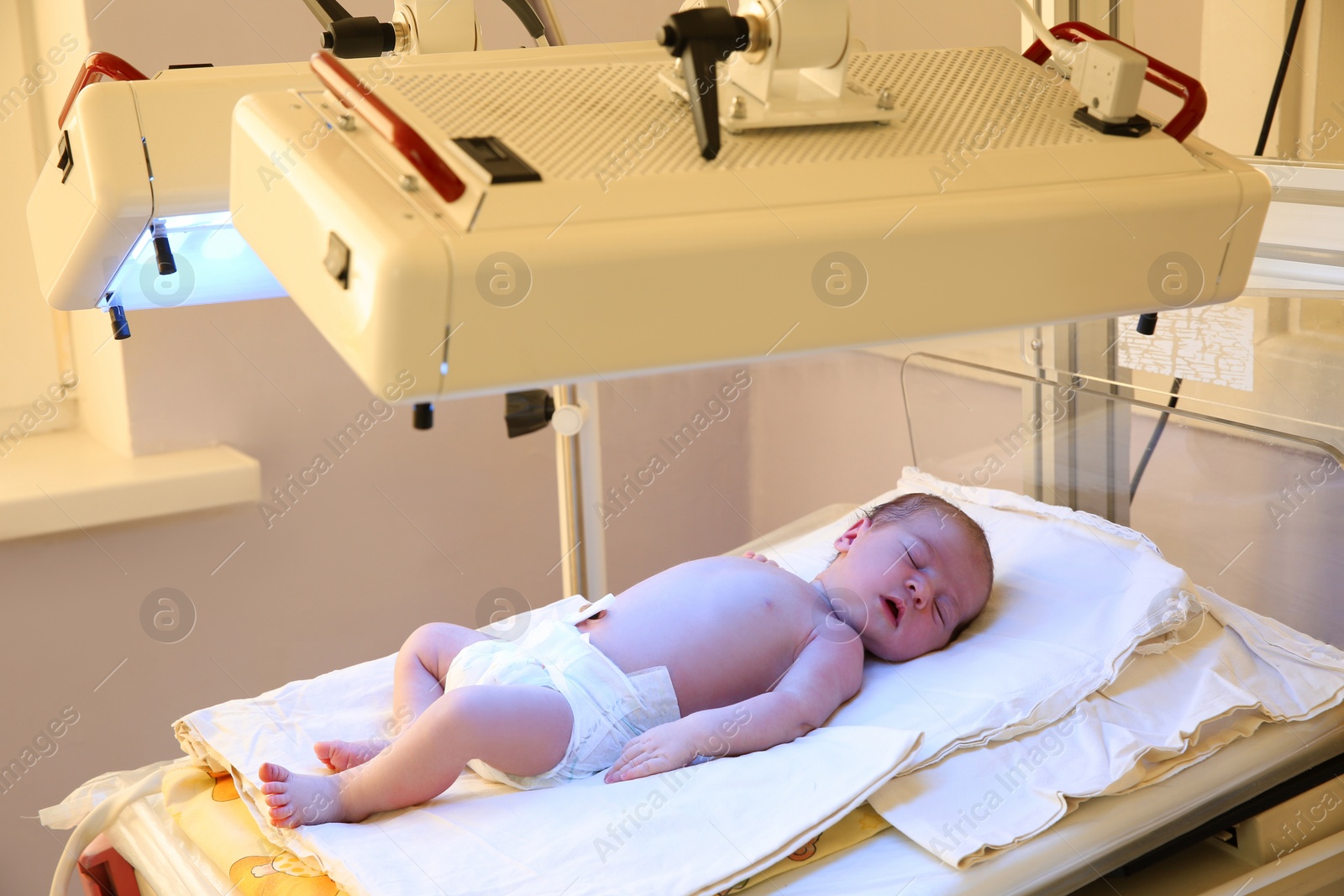 Photo of Newborn child under ultraviolet lamps in hospital