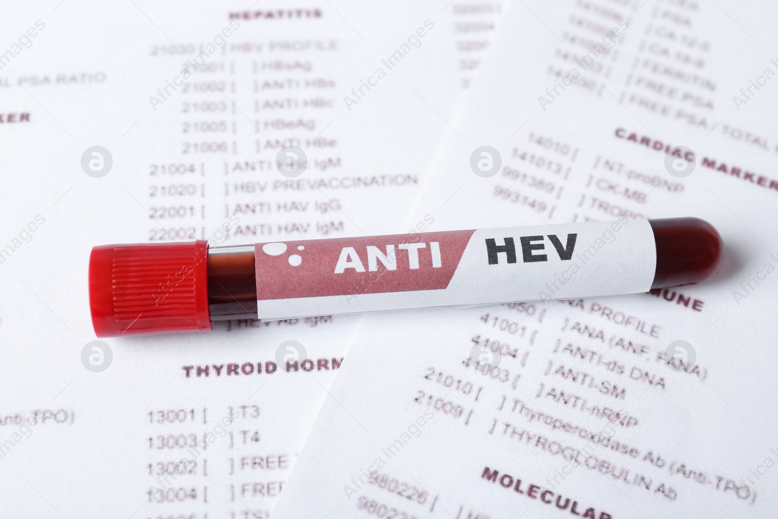 Photo of Tube with blood sample and label ANTI HEV on laboratory test form, closeup
