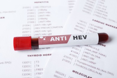 Tube with blood sample and label ANTI HEV on laboratory test form, closeup