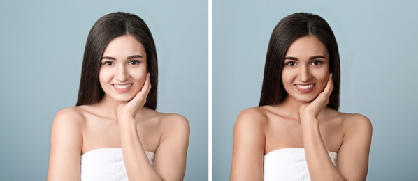 Image of Collage with photos of beautiful young woman before and after indoor tanning on light grey background. Banner design