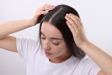 Photo of Woman with dandruff problem on white background